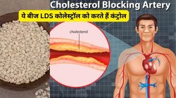 कोलेस्ट्रॉल का स्तर 130 MG/DL से 159 MG/DL तक पहुंचना डेंजर लाइन को करता है क्रॉस, इस सफेद बीज को आज ही से खाएं, झट से LDL होगा कम