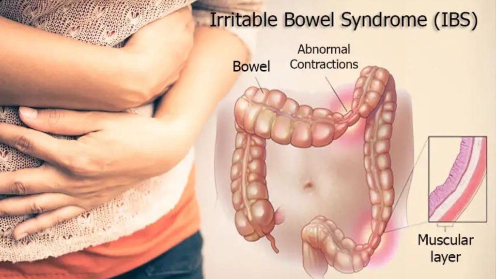 IBS,lifestyle,health,irritable bowel syndrome, irritable bowel syndrome treatment, irritable bowel syndrome in hindi, irritable bowel syndrome diet, irritable bowel syndrome home remedies IBS,lifestyle,health,irritable bowel syndrome, irritable bowel syndrome treatment, irritable bowel syndrome in hindi, irritable bowel syndrome diet, irritable bowel syndrome home remedies