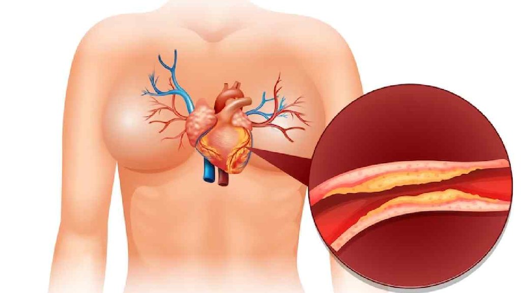 Cholesterol , cholesterol patients add lauki in diet, lauki juice cholesterol