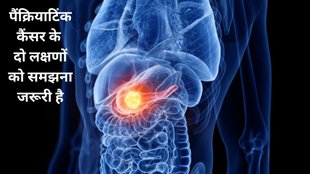 early symptoms Pancreatic cancer, quick detection of Pancreatic cancer, pancreatic cancer symptoms, pancreatic cancer treatment