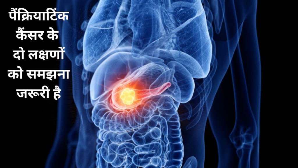 early symptoms Pancreatic cancer, quick detection of Pancreatic cancer, pancreatic cancer symptoms, pancreatic cancer treatment