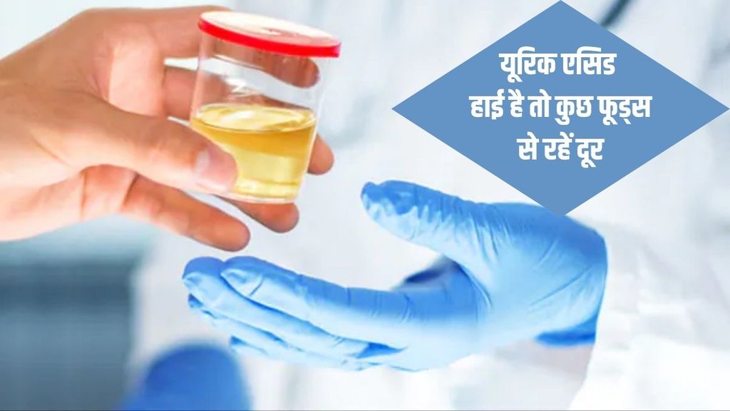 What Is Uric Acid,What Is uric acid and how to control it,uric acid treatment,uric acid treatment at home,Uric Acid Treatment in Ayurveda,