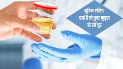 Uric Acid Control : इन 5 फूड्स का सेवन करने से किडनी टॉक्सिन को बाहर निकालना कर देगी बंद, विषैले पदार्थ बढ़ा सकते हैं यूरिक एसिड, देखिए फूड लिस्ट