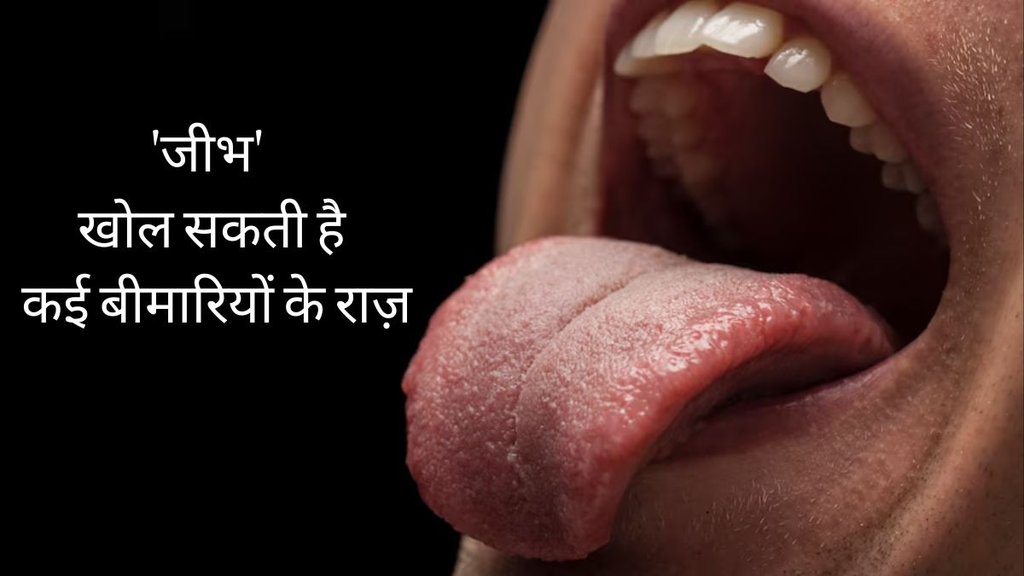 Tongue Color । Healthy Tongue Color । Diabetes । heart disease । hearth attack
