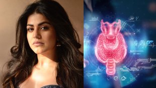 shenaz treasury । shenaz treasury health । what is hypothyroidism । Hypothyroidism Symptoms