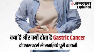 Gastric Cancer, Stomach Cancer