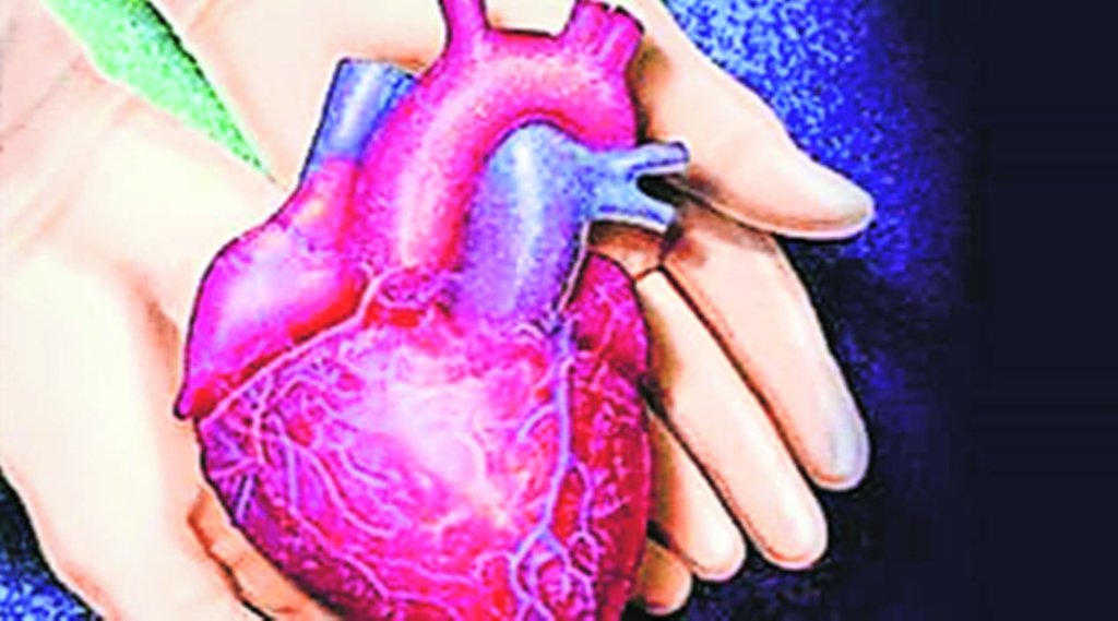 Heart | Transplant