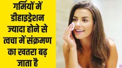 रविवारी सेहत: सौंदर्य की चिंता, जब गर्मी सताए त्वचा झुलसाए तो ऐसे करें बचाव