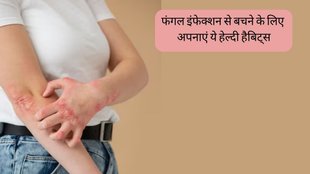 Monsoon health । How to prevent fungal infection । Preventing fungal infections in monsoon season । Tips to avoid fungal infections during rainy season