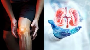 Uric Acid Diet । Uric Acid Food । Gout diet । food increase uric acid । Natural Ways to Reduce Uric Acid