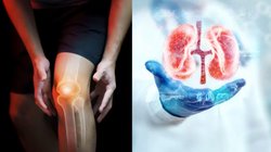 Uric Acid Diet: यूरिक एसिड को 3 गुना बढ़ा सकती हैं ये चीजें, आज ही कर दें कम वरना सड़ने लगेगी किडनी