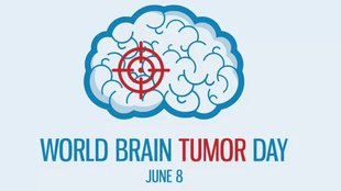 brain tumor treatment, brain tumor symptoms, Vision changes, Radiation therapy, chemotherapy,