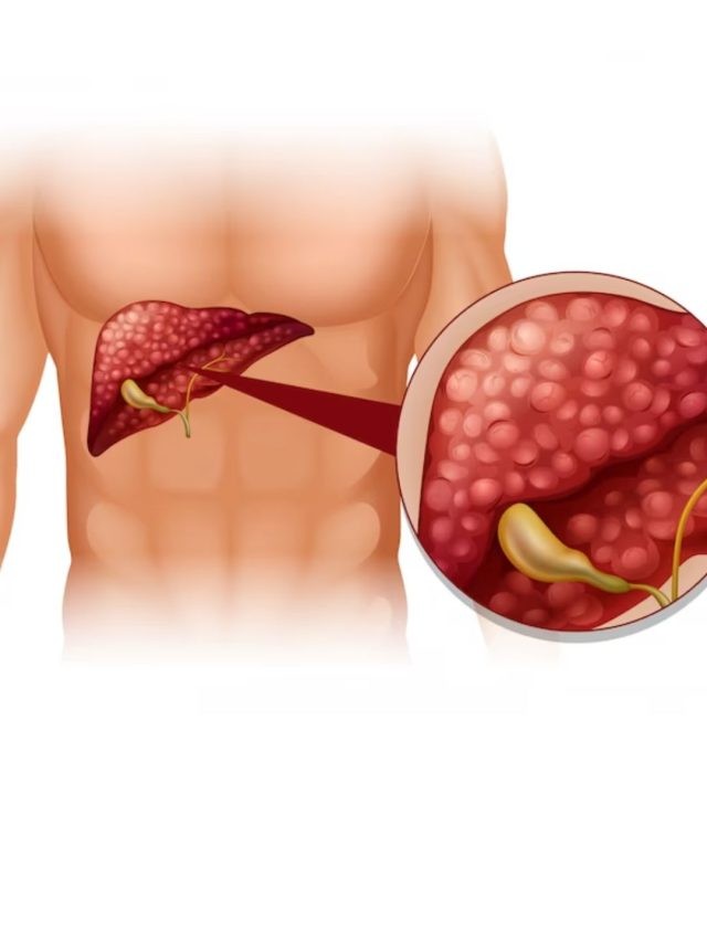 Liver को सड़ाकर गला सकती हैं ये चीजें, आज ही बंद कर दें खाना