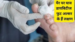 Diabetes Symptoms: पैरों में झुनझुनी और घाव होना हो सकते हैं डायबिटीज़ फुट अल्सर के सिम्टम्स, लक्षणों को नहीं करें इग्नोर, बढ़ सकती है परेशानी