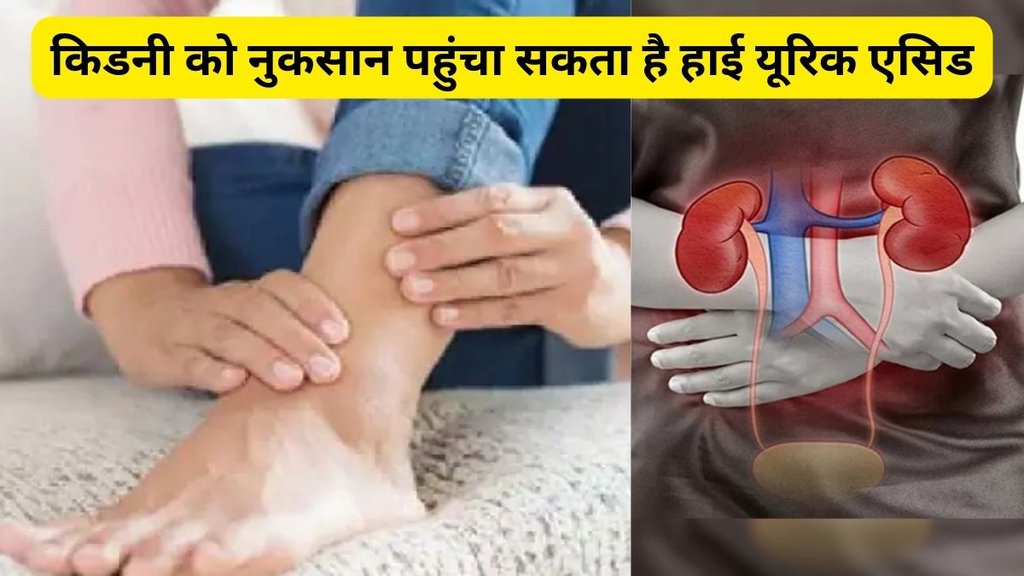 uric acid control tips,यूरिक एसिड को कैसे कंट्रोल करें