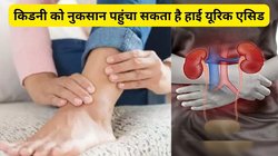 किडनी डैमेज कर सकता है 7mg/DL से ज्यादा यूरिक एसिड, जोड़ों को कर सकता है जाम, इन टिप्स से करें कंट्रोल