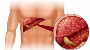 what to eat for healthy liver, what makes liver healthy, tips to detox liver,