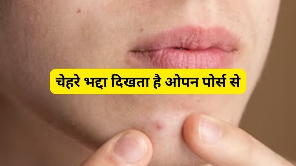 lifestyle,Skin care tips remedy,open pores,best nuskha for open pores,open pores ayurvedic remedies,open pores home remedies,open pores kaise hatayein,open pores ke gharelu upay,best upay for open pores