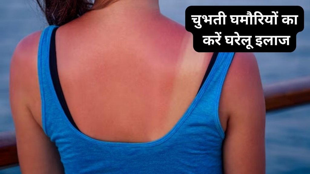prickly heat, Home Remedies, summer Home Remedies, Home Remedies For Ghamori, Heat Rash in Hindi, Ghamori ke karan, Ghamori ke gharelu ilaj