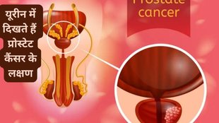 symptoms of first stage of prostate cancer, can prostate cancer be cured, can prostate cancer be 100% cured, 7 warning signs of prostate cancer,