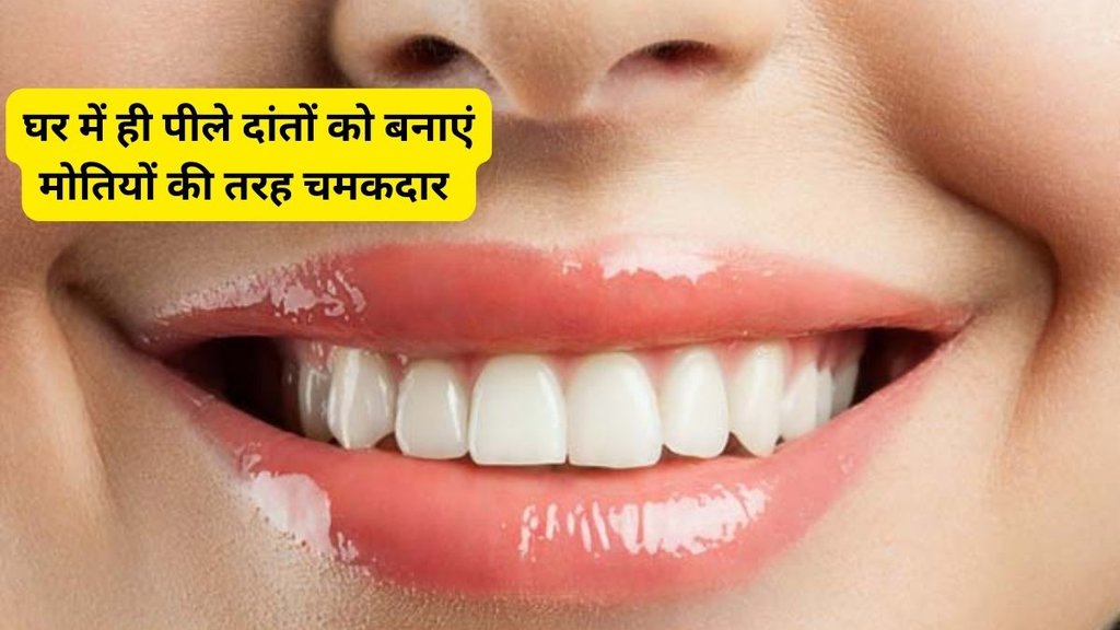 tartar home remedies,World Oral Health Day,Oral Health Day,Oral Health,Teeth Whitening Tips, home remedies for white teeth,