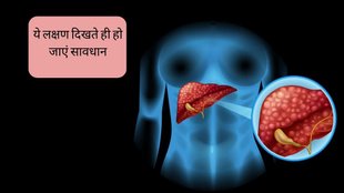 Fatty Liver । Fatty Liver Symptoms । Fatty Liver Symptoms on face । Fatty Liver Symptoms On Skin