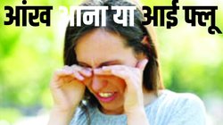 रविवारी सेहत: वायरल कंजक्टिवाइटिस- बरसात आई तो आंख आई, नेत्रों की देखभाल जरूरी