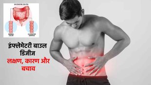 Inflammatory Bowel Disease। IBD Symptoms। IBD Causes। IBD Medical Test