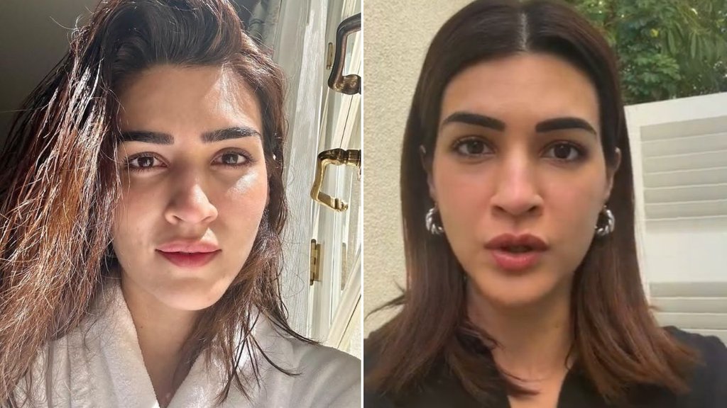 Kriti Sanon Trolls for Swollen Face