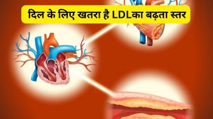 juices to lower cholesterol, juices in high cholesterol, कोलेस्ट्रॉल बढ़ने पर कौन सा जूस पीना चाहिए,
