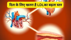 नसों को कमजोर और ब्लॉक कर देता है 500 mg/dL तक कोलेस्ट्रॉल, दिल के रोगों का बढ़ता है खतरा, इन दो फ्रूट्स जूस का करें सेवन, तुरंत LDL निकलेगा बॉडी से बाहर