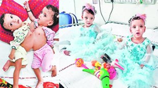 Ridhi and sidhi | Patient