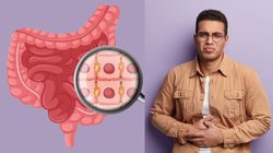 आंतों में जमा गंदगी को रातभर में पिघलाकर बाहर कर सकती हैं ये 3 जड़ी-बूटियां, गैस-अपच से दिनभर मिलेगी राहत, जानिए तरीका