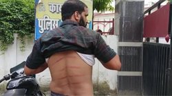Twitter पर शिकायत करना शख्स को पड़ा भारी, थानेदार ने की बेल्ट से पिटाई! वायरल हो रही शख्स की तस्वीर