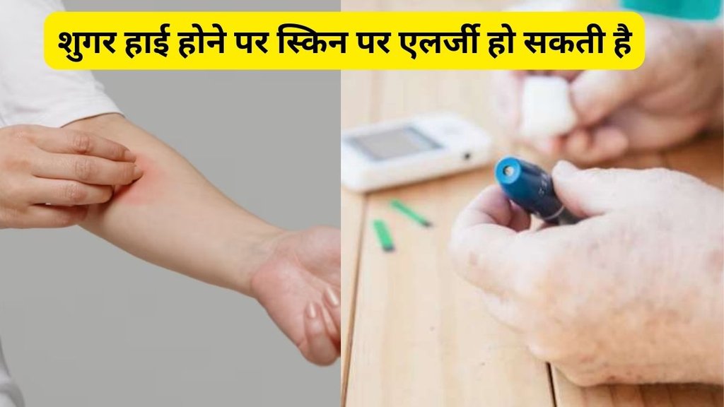 how to identify diabetes in skin, diabetes unusual symptoms, diabetes symptoms on toes, diabetes symptoms on skin, diabetes symptoms on neck, diabetes symptoms on foot, diabetes symptoms on eyes, diabetes symptoms on body parts