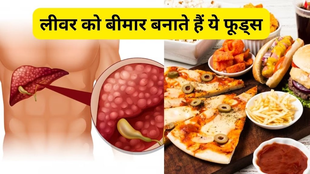 How can I improve my liver naturally,लीवर की सेहत कैसे ठीक रखे