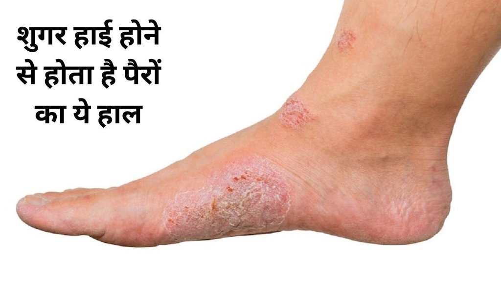 what are the 3 main signs of diabetes, what are the 10 early signs of diabetes, how does diabetes affect your toes, can diabetic legs be cured