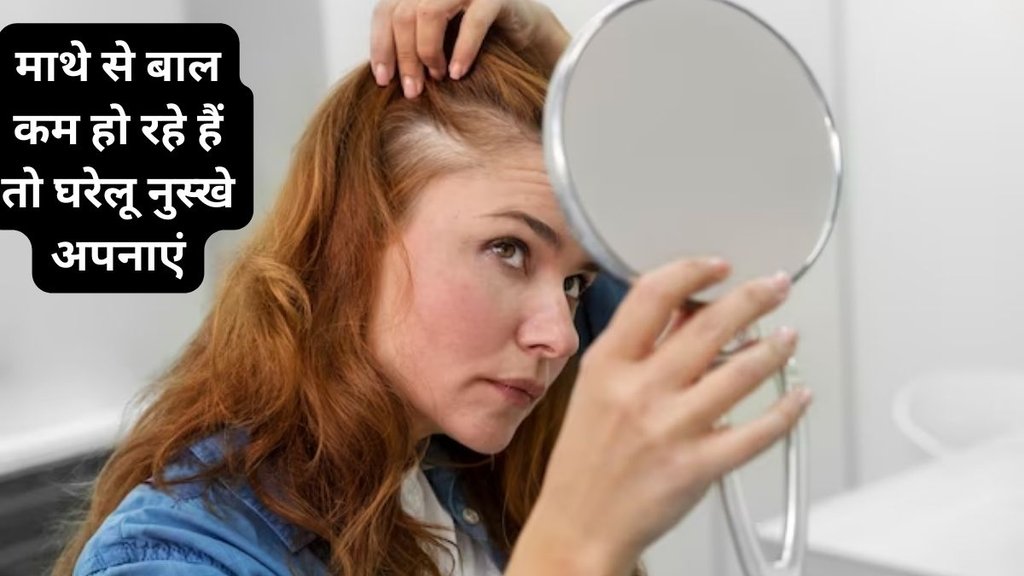 best home remedies to get rid of hair fall,हेयर फॉल,माथे के बाल कम हो रहे हैं तो कैसे बढ़ाएं