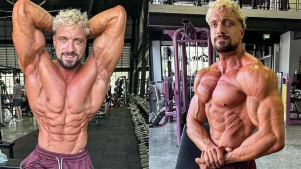 can aneurysm cause blood clot, aneurysm risk factors, aneurysm kya hai, aneurysm, fitness influencer jo lindner, Health & Fitness Photos