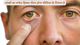 bilirubin, jaundice,घरेलू इलाज, बचने के तरीके, पीलिया, बिलीरुबिन, पीलिया दूर करने से घरेलू तरीके,Hindi News, News in Hindi, sugarcane juice,turmaric juice