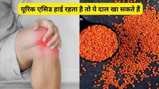 Is urad dal good for uric acid,Is kidney beans harmful for uric acid,Purine Foods,purin rich food,