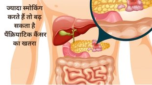 pancreatic cancer causing habit, pancreatic cancer causes, pancreatic cancer, pancrease function, habits that cause pancreatic cancer