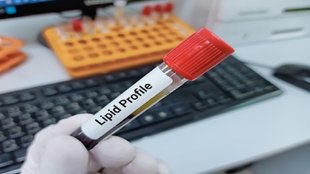 cholesterol reduce tips, tulsi leaves control cholesterol, tulsi leaves powder reduce ldl level,