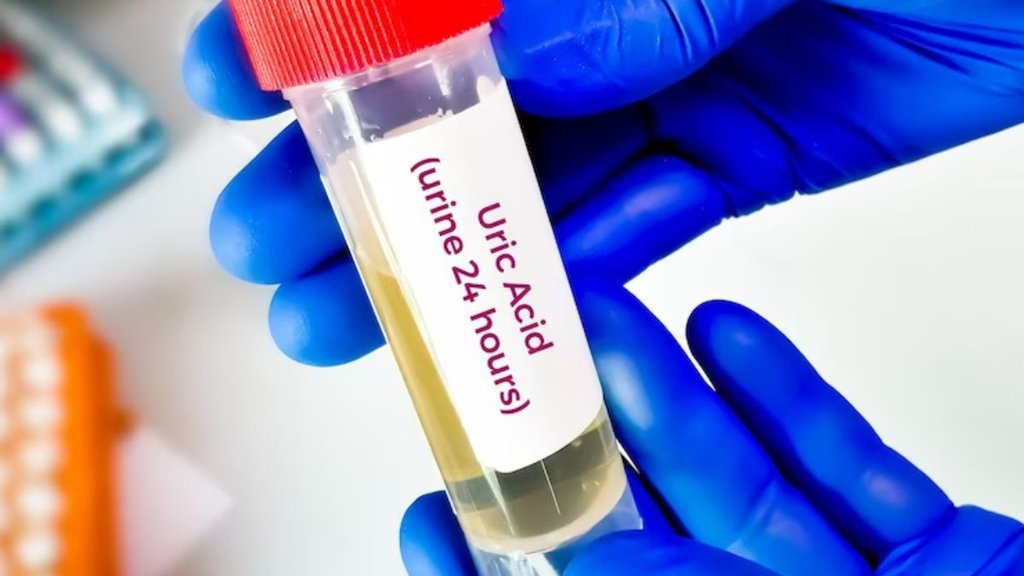 uric acid food list, uric acid test, uric acid pain, uric acid cure, uric acid treatment, uric acid increase,