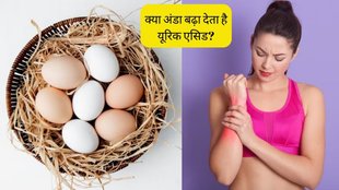 Eggs In Uric Acid । Gout Diet । Eggs and Gout । Arthritis