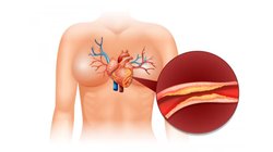 Bad Cholesterol: ब्रेकफास्ट के बाद करें आधा चम्मच इस पाउडर का सेवन, कोने-कोने से बाहर होगा बैड कोलेस्ट्रॉल, खुल जाएंगी बंद नसें