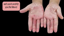 Peeling Skin: मानसून में छिलके जैसी उतरने लगी है हाथ की स्किन? ये हो सकते हैं कारण, जानें कैसे पाएं इससे छुटकारा