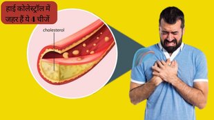 High Cholesterol । Foods to avoid in High cholesterol । foods not to eat in high cholesterol