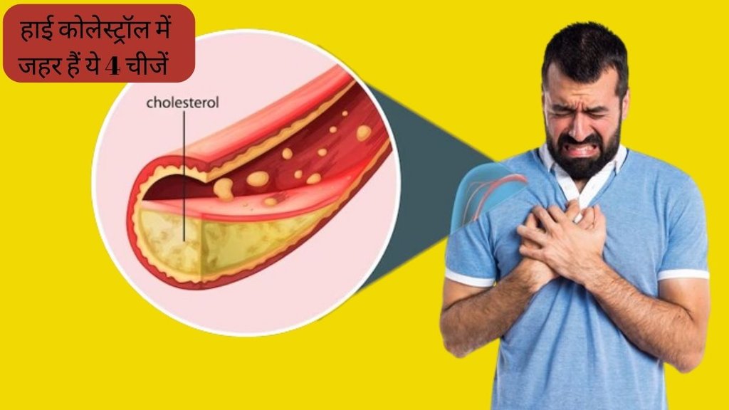 High Cholesterol । Foods to avoid in High cholesterol । foods not to eat in high cholesterol