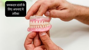 Teeth Whitening Tips । ayurvedic remedies for white teeth । How to Get Rid of Yellow plaque on Teeth । How to Get Rid of Yellow tartar on Teeth
